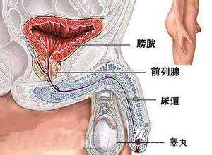 前列腺癌如何检查呢